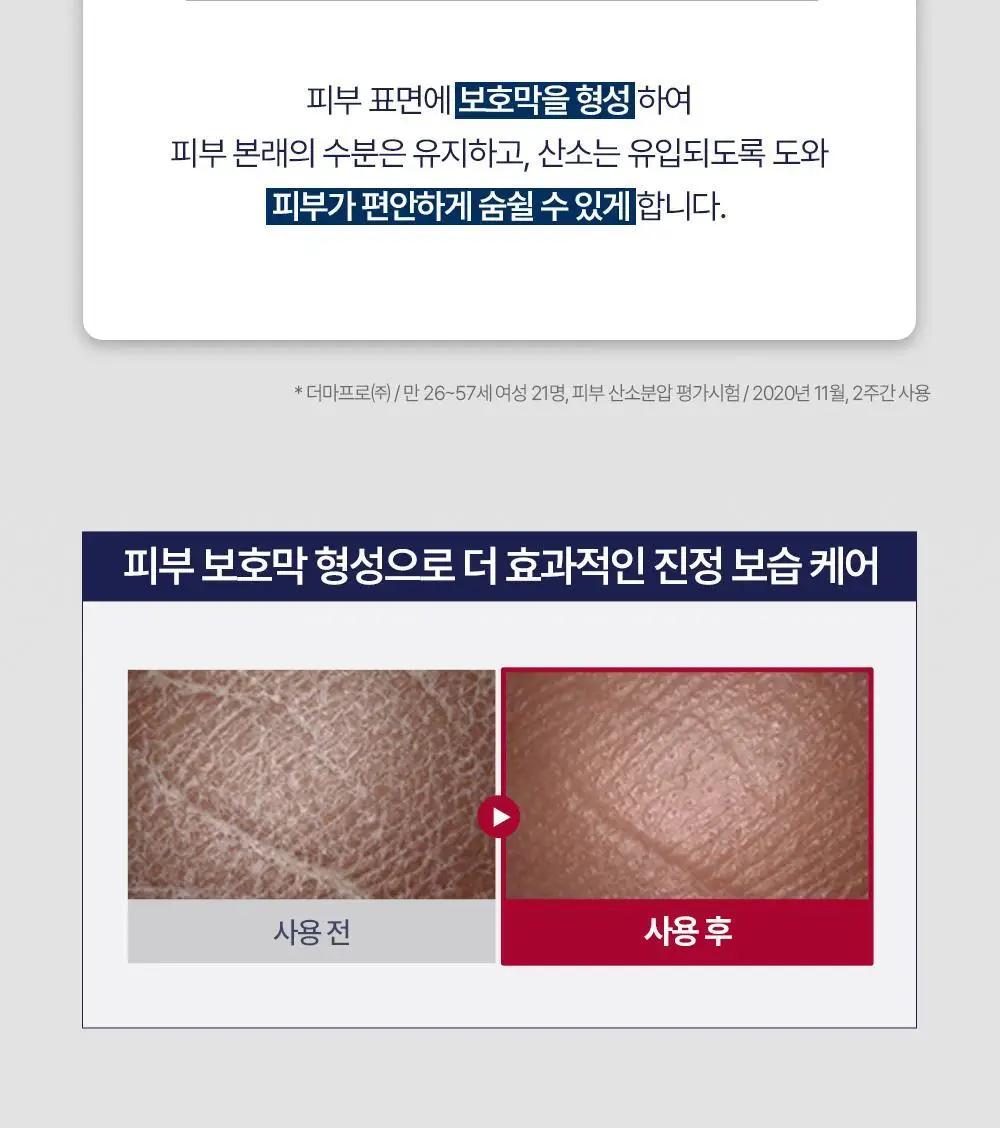 [정품/올영단독] 유세린 아쿠아퍼 오인트먼트 449ml 상세페이지 10